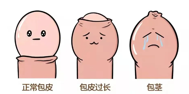 到底啥样的包皮需要割？出现这几种情况...