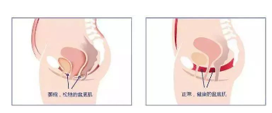 医源性损伤