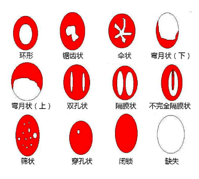 卫生棉条