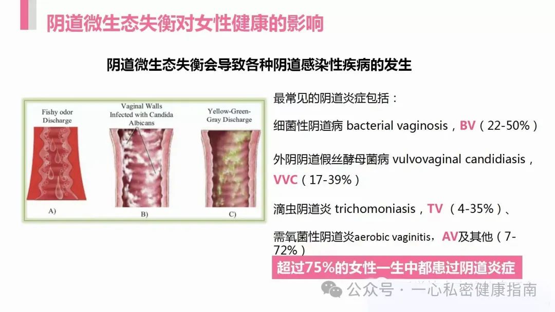 女性私密保养避坑攻略